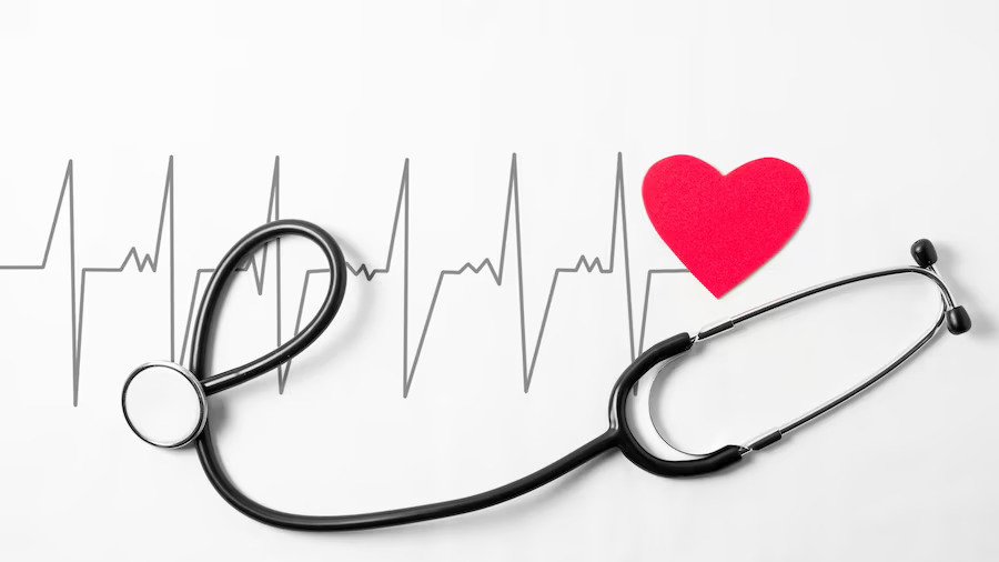 ECG