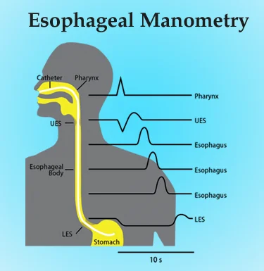 Manometry