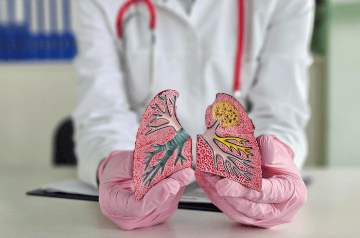Empyema and Pneumothorax